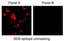 Carbonic Anhydrase IX/CA9 Antibody, Biotin, Novus Biologicals 0.1mL; Biotin:Antibodies,